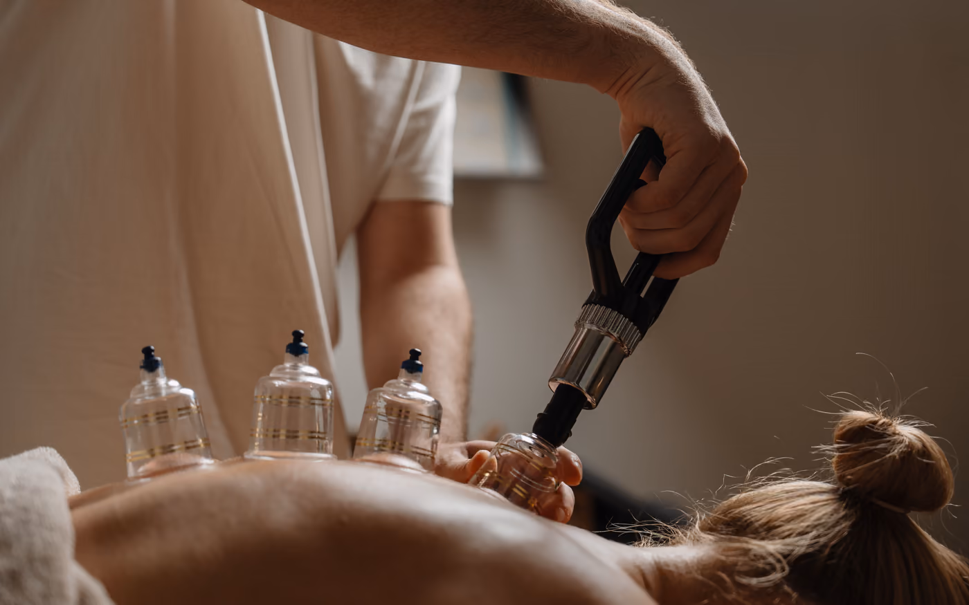 Cupping glasses on the back